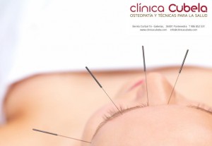 acupuntura en pontevedra